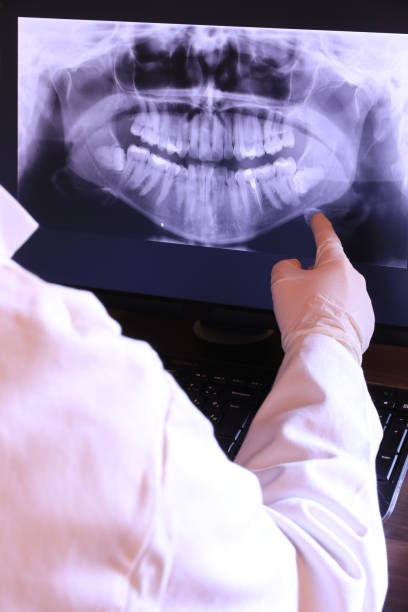 Best Emergency Wisdom Teeth Removal in Yadkinville, NC
